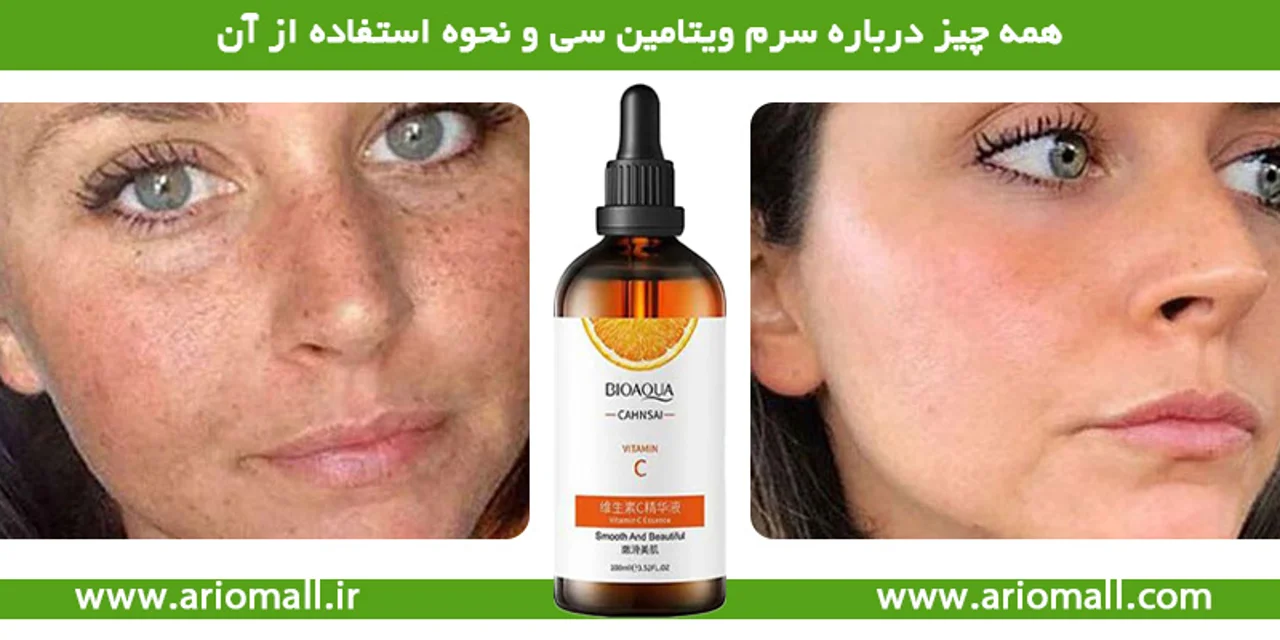 همه چیز درباره سرم ویتامین سی و نحوه استفاده از آن